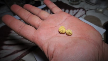 Sponge Gold In Burkina Faso